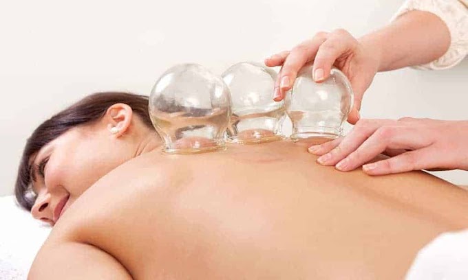Fire Cupping Therapy Cost