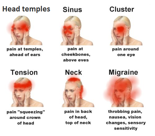 Headache Swollen Lymph Nodes Neck Pain - Headache