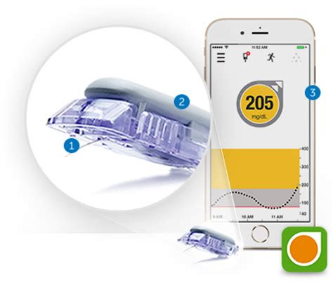 dexcom tizen