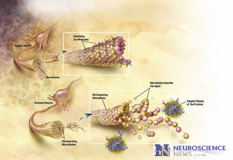 Image shows the tau protein.