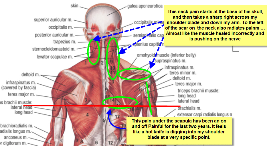 Diagram Of Bones In Neck And Shoulder - Neck And Shoulder Muscles
