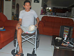Pelegrino Thomaz amputou a perna há pouco mais de três meses  (Foto: Tácita Muniz/G1)