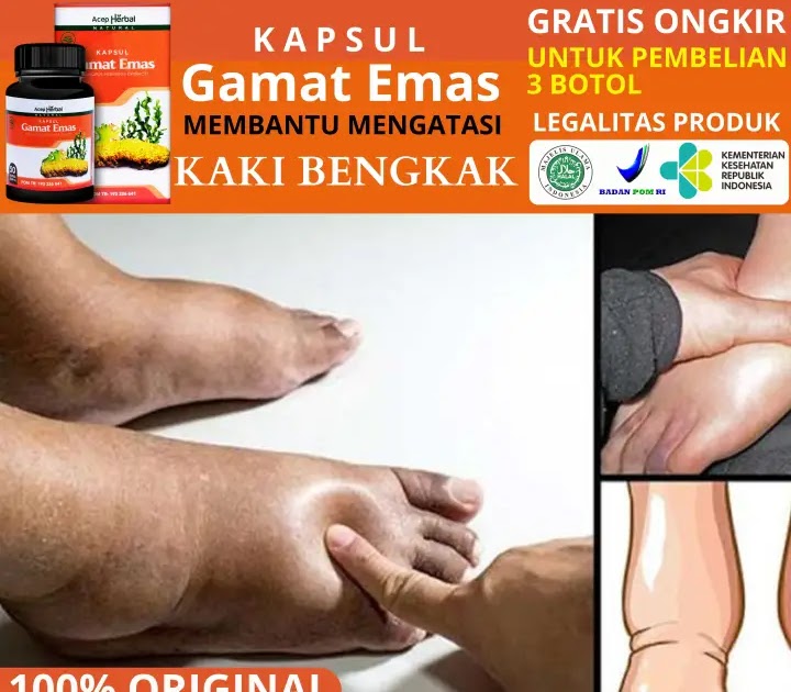 Obat Tradisional Untuk Bengkak Akibat Kesleo : Dinas Kesehatan Provinsi Banten Cara Mengobati ...