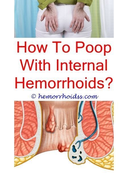 What Kind Of Doctor Do I See For Bleeding Hemeroids - 51 Unique and