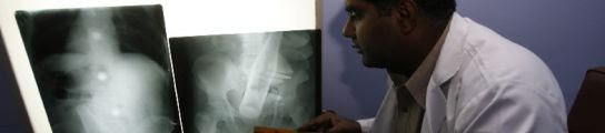 El médico muestra la radiografía del abdomen del hombre (REUTERS)