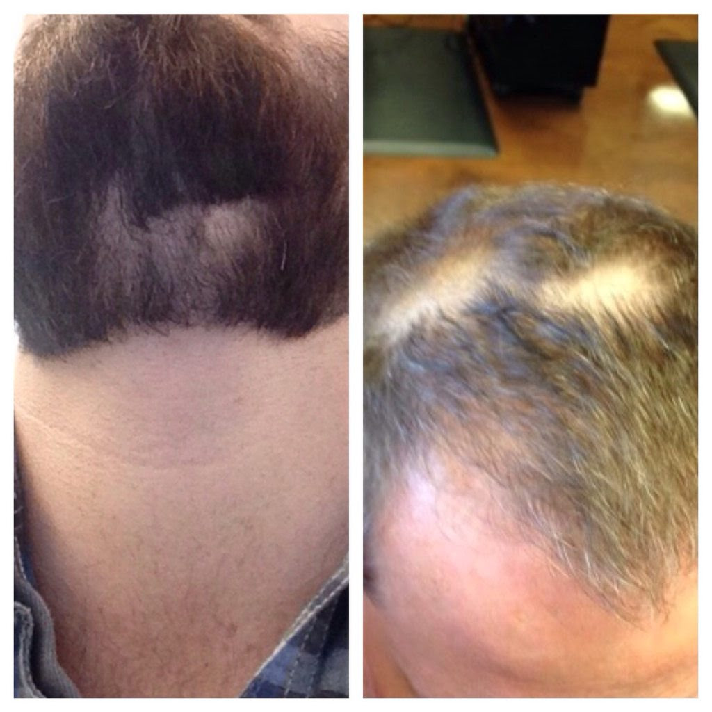 How Does A Hair Drug Test Work This method to pass a hair follicle