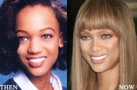 . Posted on Photos, read full story at Tyra Banks Nose job Photo Before and ...