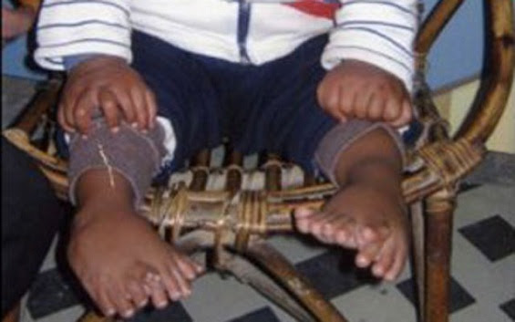 Pequeno Akshat Saxen, de 1 ano. Pequeno Akshat Saxen, de 1 ano.