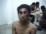 injured_2.jpg
