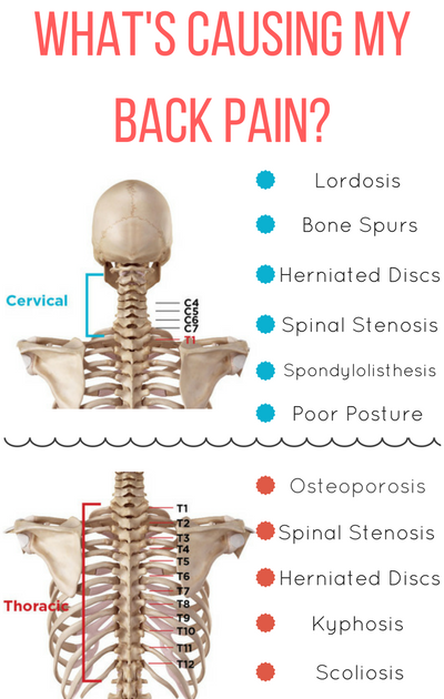 Upper Back Back Bones Diagram - The bones of the upper body - Stock