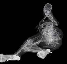 naked xray women