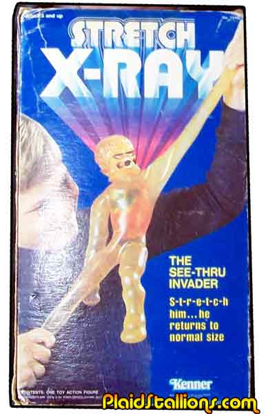 boxed stretch x ray