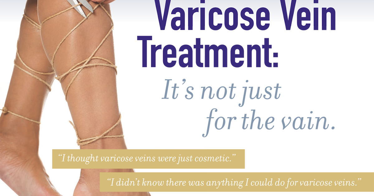 veins ayurvedic treatment varicose