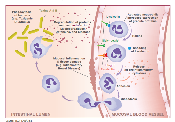 Lactoferrin Stool Test Positive - Stools