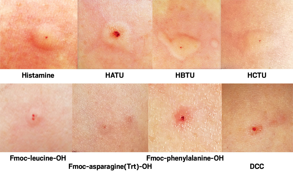 Allergy Trigger Do Cat Allergies Cause Rashes