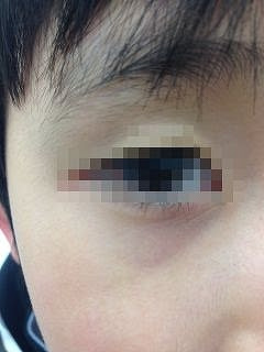 綺麗な子供 目の下 くま かわいい子供たちの画像