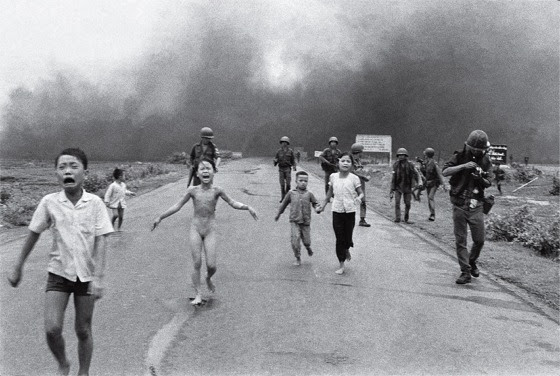 Napalm Attack Victims Napalm attack victims