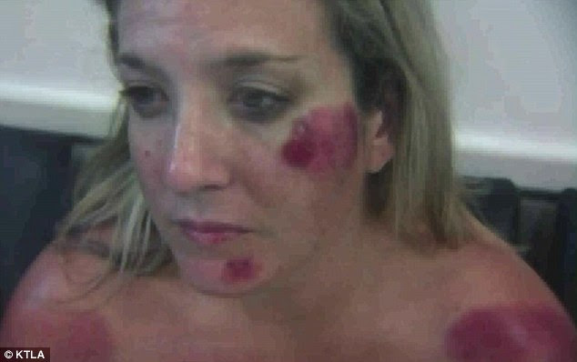 Attack: Michelle Jordan, 34, shows off her injuries after she was allegedly repeatedly thrown to the floor by LAPD officers after she was pulled over for talking on her mobile phone while driving