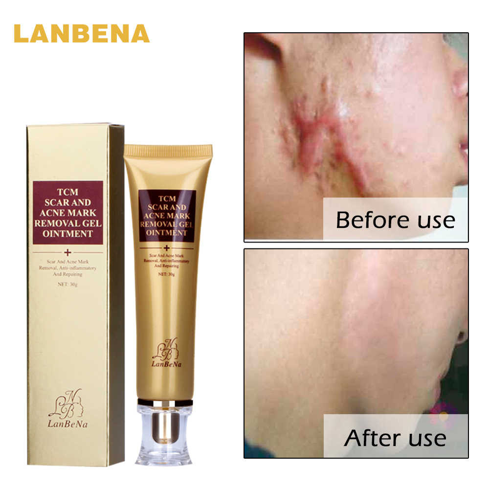 scratch skin marks remove scars healed natural naturally remedy weeks using