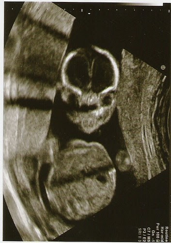 meet baby brother!