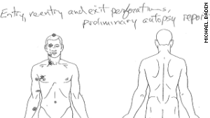 A diagram from the autopsy shows entry and exit wounds.