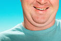 double chin