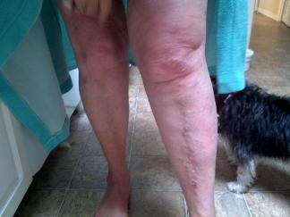dammaged leg