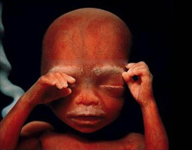 Incredible Photos: A
Child is Born Incredible Photos: A Child is Born