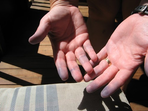 BlueHands.jpg