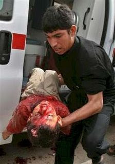 Wounded Iraqi child