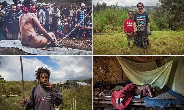 Witch burnings are on the rise in Papua New Guinea