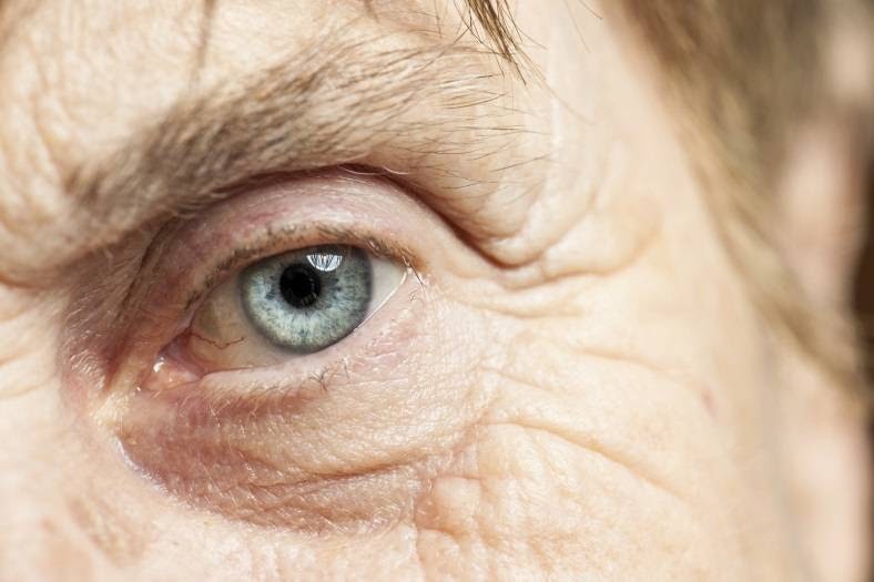 Dor No Canto Interno Do Olho Esquerdo - Sobre os Olhos