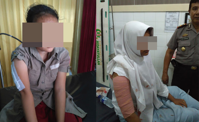 Paling Keren 15+ Gambar Tangan Yang Di Silet Gani Gambar