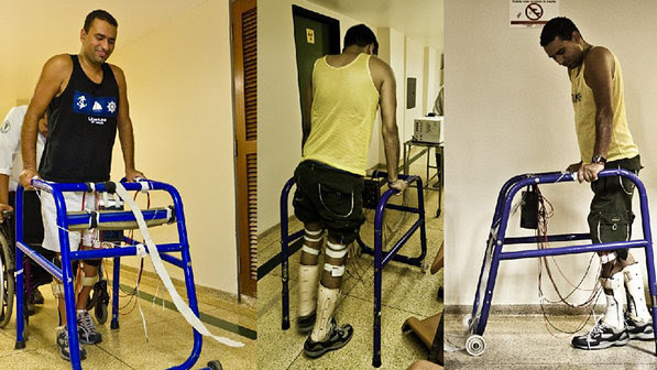 Paciente paraplégico durante condicionamento muscular dos membros inferiores utilizando a Estimulação Elétrica Neuromuscular (Reprodução/EESC USP)