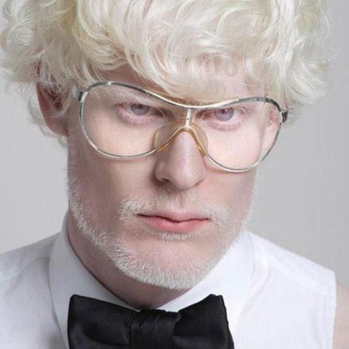 A beleza única dos albinos A beleza única dos albinos