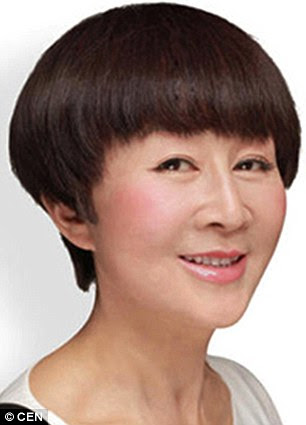 This unidentified woman is pictured after cosmetic surgery