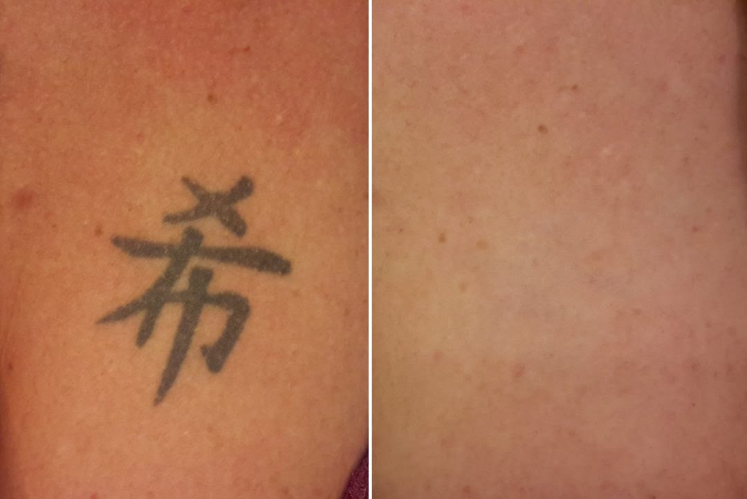 Engelsflugel Tattoo Auf Der Brust