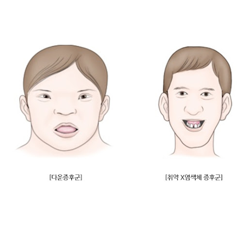[교육심리학] 지적장애 Intellectual disability