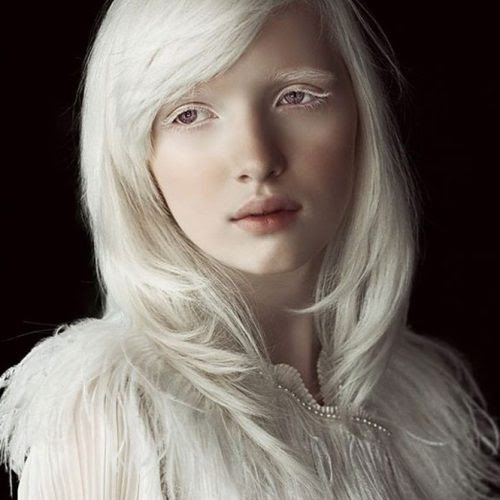 A beleza única dos albinos A beleza única dos albinos