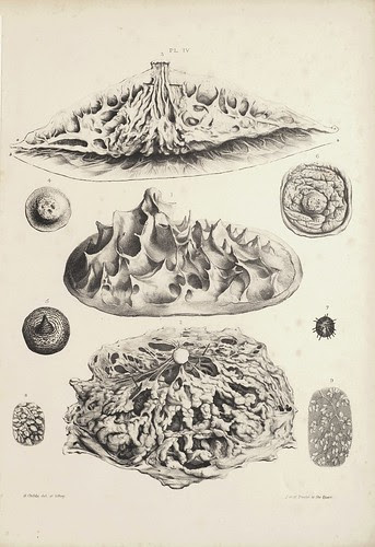 Ligaments Suspensoria and Sections (Cooper, 1840)