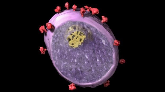 Vijesti iz Svijeta: When HIV and AIDS appeared they seemed to come from