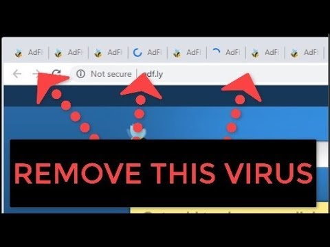 Zombiebears Official Website How To Remove The Popup Virus