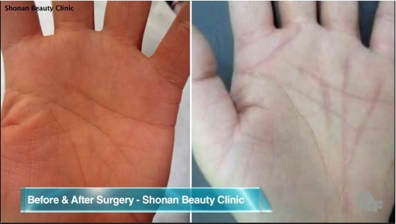 As cirurgias mais inúteis que são modinha As cirurgias mais inúteis que são modinha
