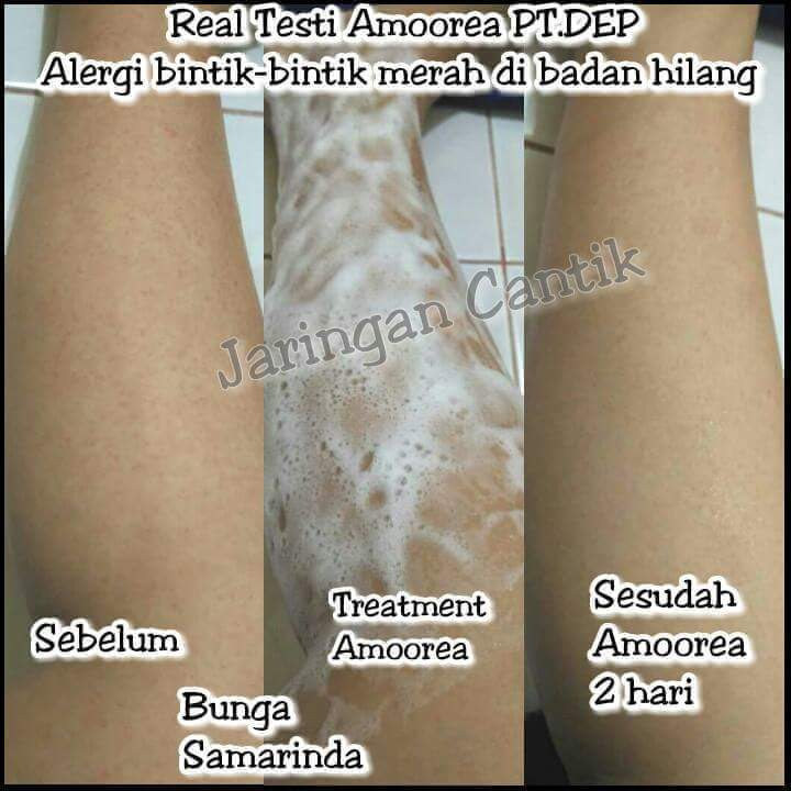 Foto Testimonial Pemakaian Amoorea Foto Testimonial Pemakaian Amoorea