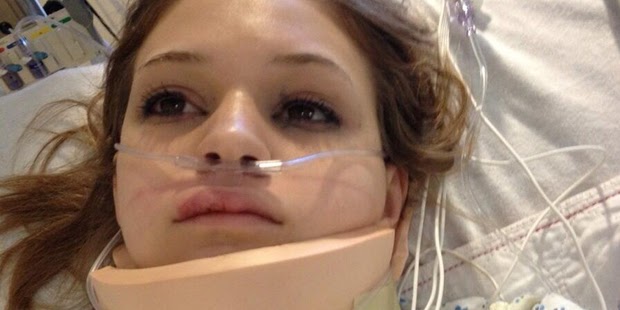 Welcome To Damposs Blog Teen To Make Full Recovery After 1km Fall
