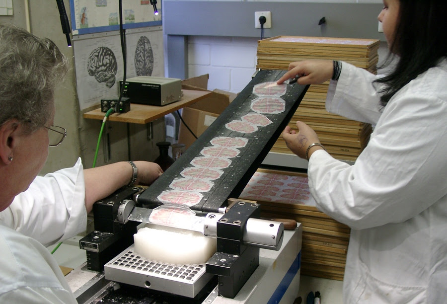 BrainSlices