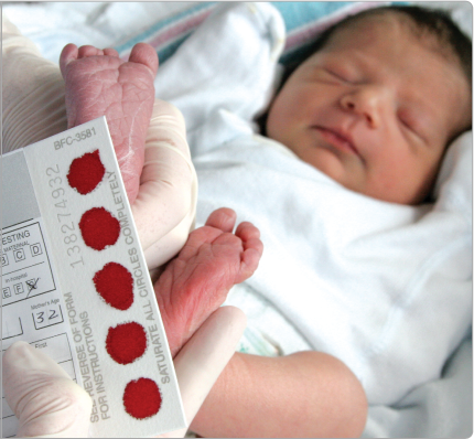 Newborn Baby Screening Newborn Baby