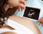 ¿Existen factores genéticos que regulen la duración del embarazo?