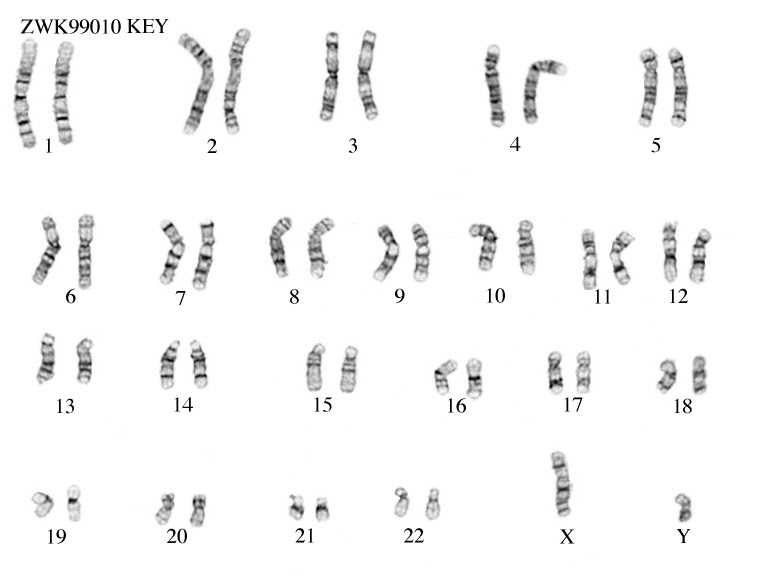 37-biology-karyotype-worksheet-answers-key-combining-like-terms-worksheet