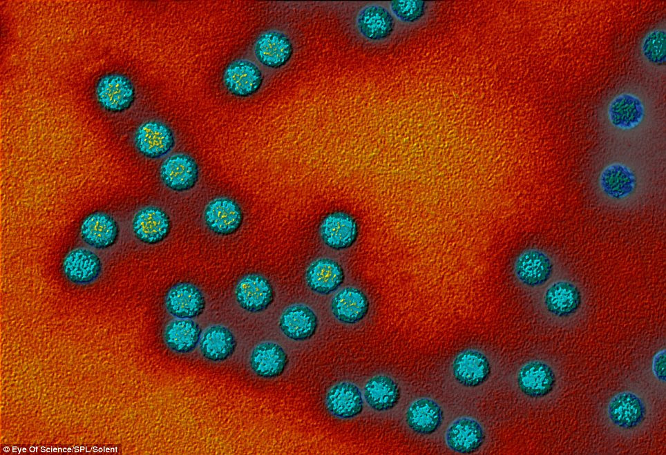 Polio viruses: RNA genetic material occurs in the core of each virus, surrounded by a protein coat (blue). There are three types of polio viruses, type 1 being the cause of most polio epidemics. Magnification: x90,000